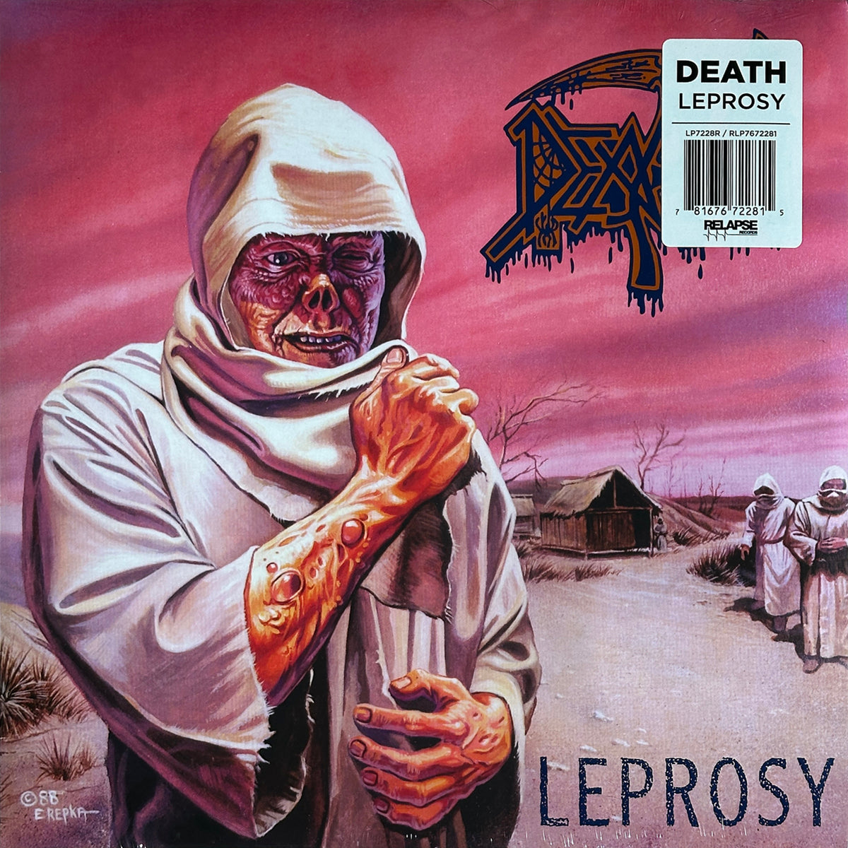 Leprosy